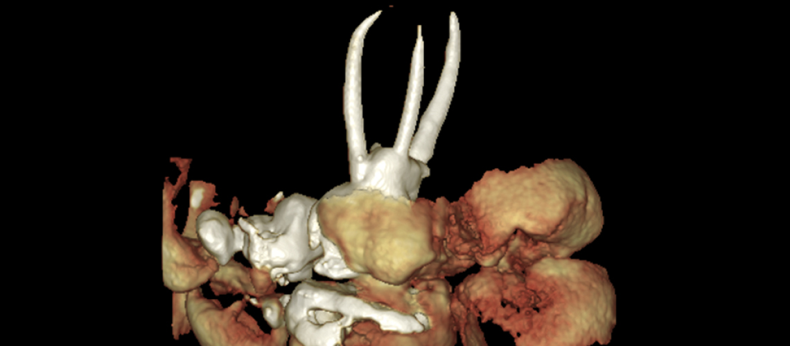 Endodontic imaging mode