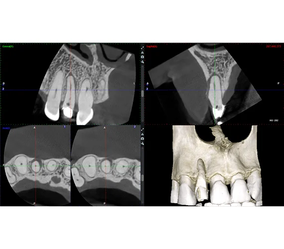 planmeca-viso-g5-endo-mode.jpg