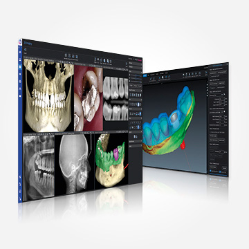 Planmeca Romexis software dental imaging