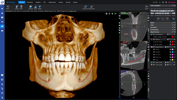 romexis-3d.jpg