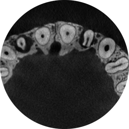 Endodontic imaging mode with AINO